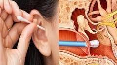 3 kesalahan yang sering kita lakukan saat membersihkan telinga yang bisa membahayakan 