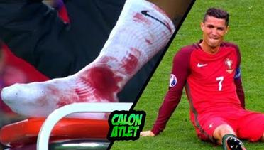 Mengerikan! Inilah Cedera Paling Parah yang Pernah Terjadi pada Dunia Sepakbola!