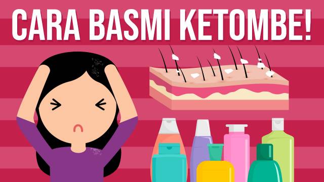 Ketombe? Ini Cara Membasminya!
