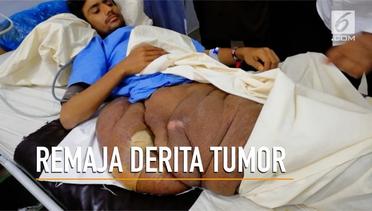 Tumor 20 Kg di Kaki Remaja Pakistan