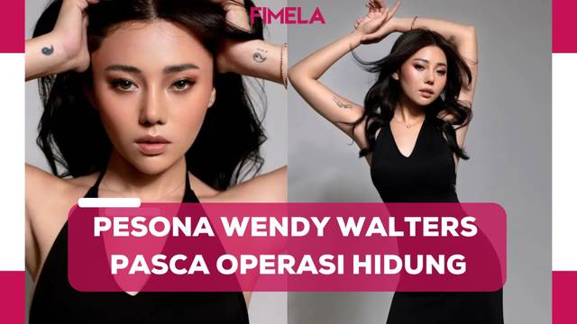 Penampilan Terbaru Wendy Walters Pasca Operasi Hidung, Cantiknya Banjir Pujian dan Dukungan