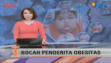 Kondisi Rizki, Bocah Obesitas Asal Palembang Semakin Membaik - Liputan 6 Petang