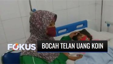 Koin Seribuan Berhasil Diangkat dari Tenggorokan Bocah di Medan
