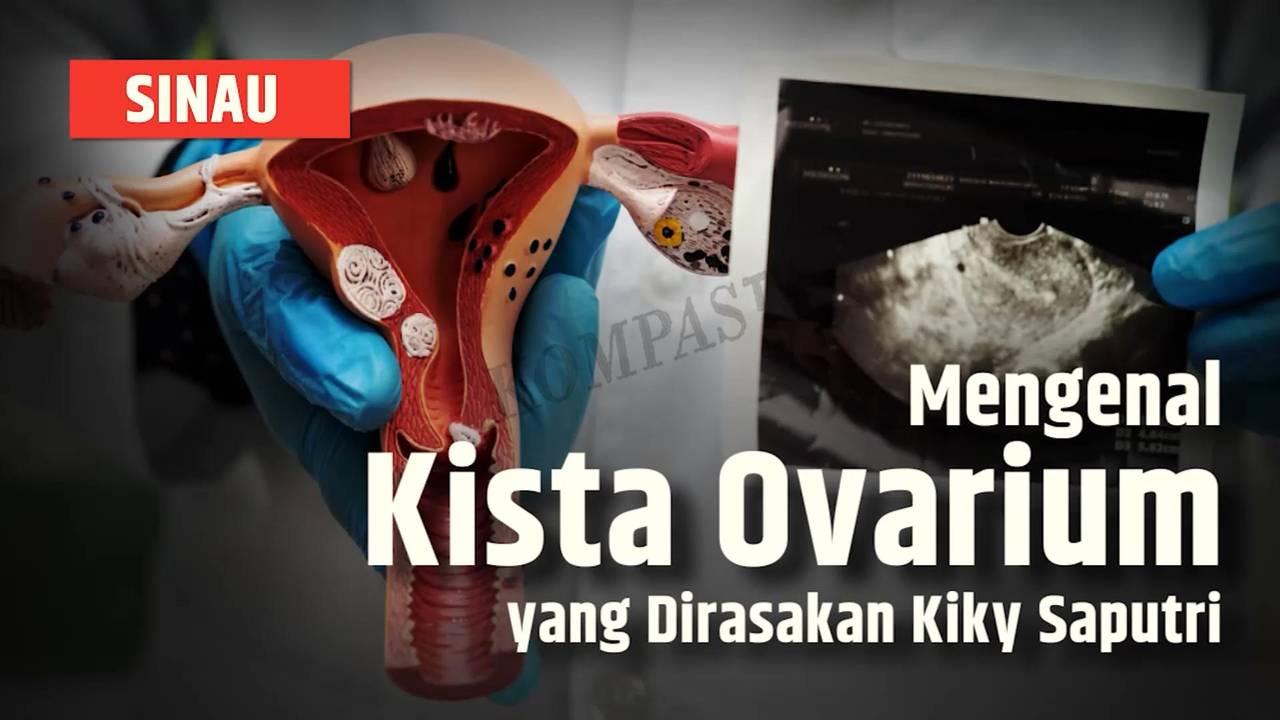Apa Itu Kista Ovarium yang Dialami Kiky Saputri, Begini Penjelasannya