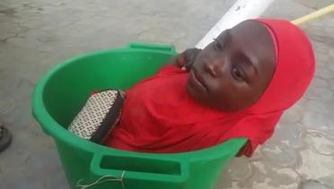 Kisah Mengharukan Gadis 'Ember Plastik' Tak Bertungkai di Nigeria