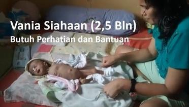 Bocor Jantung, Vania Siahaan (2,5 Bulan) Butuh Biaya Operasi ke Jakarta