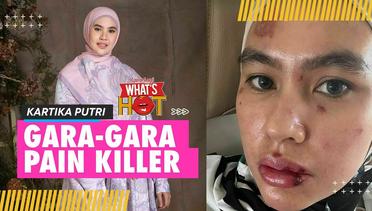 Klarifikasi Lengkap Kartika Putri Soal Wajahnya, 5 Tahun Idap Autoimun - Ruam Karena Pain Killer