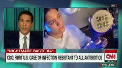 'Nightmare' drug-resistant bacteria found in U.S.