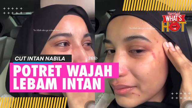 Cut Intan Nabila Posting Foto Luka & Wajah Lebam Setelah Disiksa, Selipkan Pesan Pilu