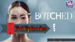 Watch Botched — Season 6 Episode 2 : Not OK From the UK