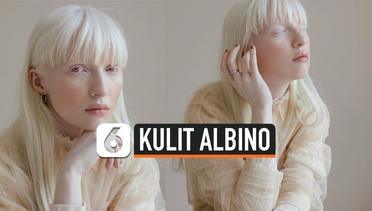 Miliki Kulit Albino, Wanita ini Tumbuh Bak Malaikat Cantik 