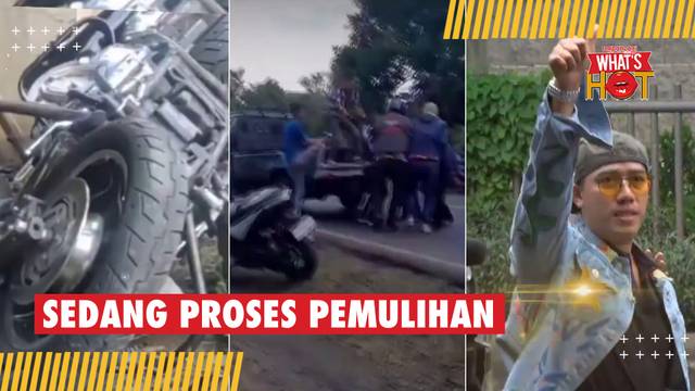 Sudah Bisa kembali Beraktivitas Setelah Kecelakaan, Begini Kondisi Ruri Repvblik Sekarang