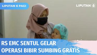 RS EMC Sentul, Bogor, Gelar Operasi Bibir Sumbing Gratis | Liputan 6