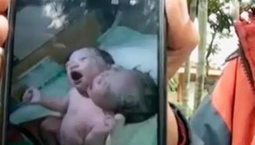 VIDEO: Bayi Berkepala Dua Lahir di Makassar