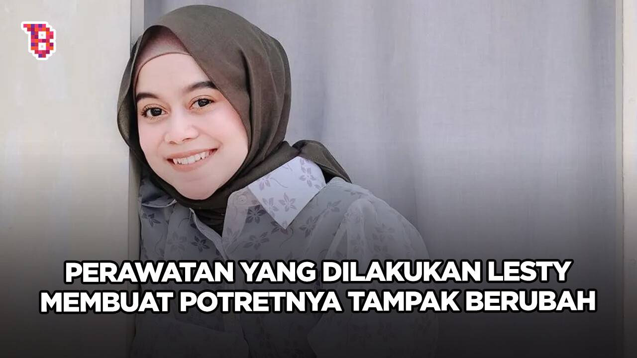 Akui tak jalani operasi plastik, potret Lesty Kejora sebelum dan