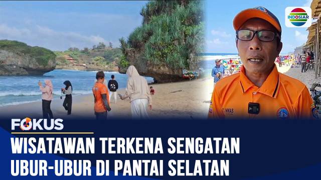 Puluhan Wisatawan di Gunungkidul Tersengat Ubur-Ubur, Mayoritas Anak-Anak Alami Reaksi Alergi | Fokus