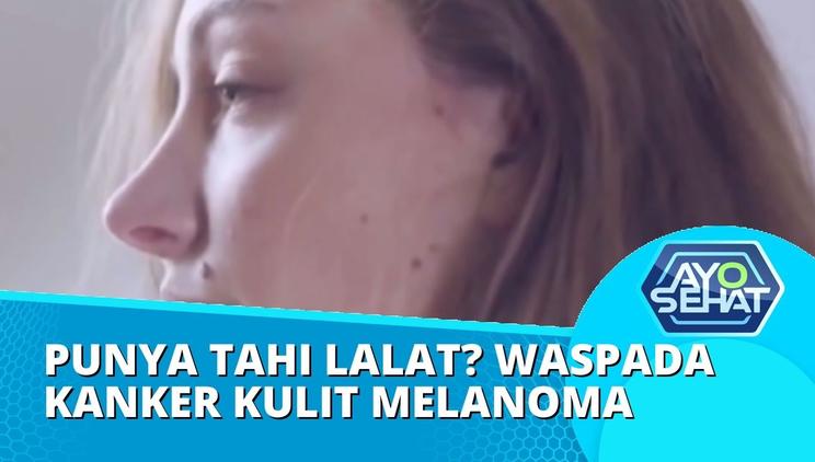 Nonton Video Ciri Ciri Tahi Lalat Ganas Terbaru Vidio