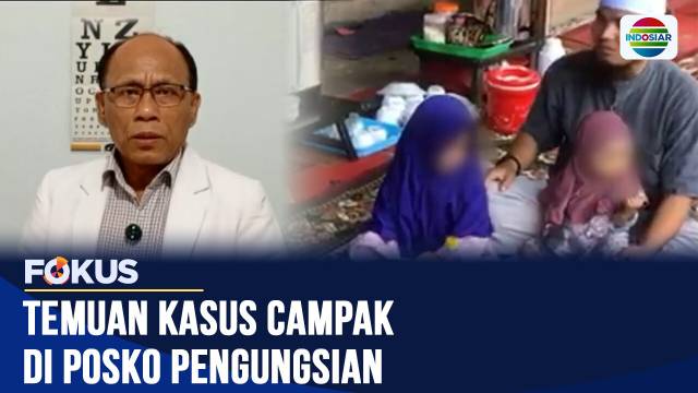Cegah Penularan Campak, Dinkes Agam Vaksinasi dan Minta Pengungsi Isolasi Mandiri | Fokus