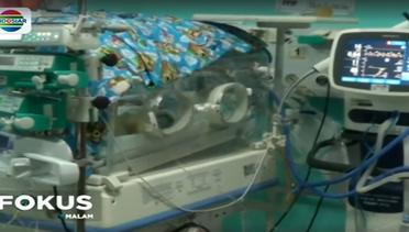 Sofia, Bayi Kembar Dempet Siam Meninggal Dunia Pasca Operasi - Fokus Malam