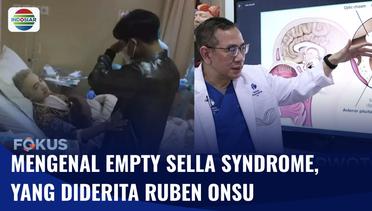 Ruben Onsu Sudah Kena, Simak Gejala dan Penyebab Empty Sella Syndrome! | Fokus