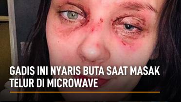 Gadis Ini Nyaris Buta Saat Masak Telur di Microwave