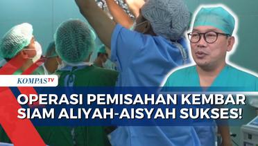 Perdana, Operasi Pemisahan Kembar Siam Sukses Dilakukan Tim Dokter RS Saiful Anwar Malang!