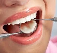 Tips Kesehatan Gigi Mulut