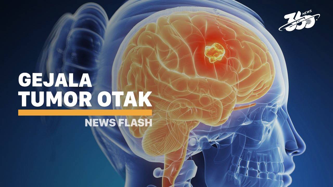 Ada Tumor Di Kepala Ria Irawan Yuk Kenali Gejala Tumor Otak Vidio