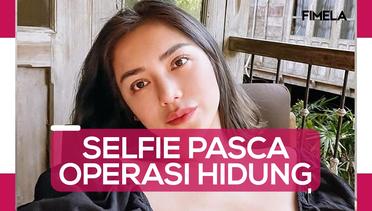 Jessica Iskandar Pamer Selfie Pasca Operasi Hidung, Dipuji Tetap Natural dan Tidak Berlebihan