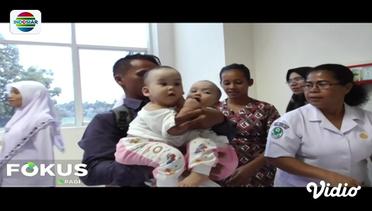 Bayi Kembar Siam di Medan Jalani Operasi Pemisahan – Fokus Pagi