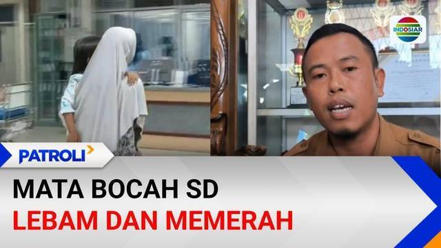 Mata Lebam, Siswi SD di Palembang Diperiksa Medis, Orang Tua Laporkan ke Polisi | Patroli