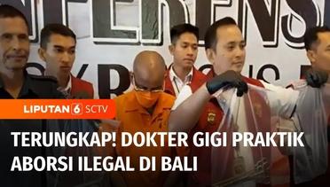Praktek Aborsi Ilegal oleh Dokter Gigi di Bali Diungkap Polisi | Liputan 6