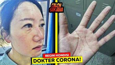 Keriput & Wajahnya Jadi Gitu! Inilah Penampakan Tangan dan Wajah Petugas Medis Pasien Virus Corona!
