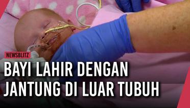 Bayi Lahir dengan Jantung di Luar Tubuh