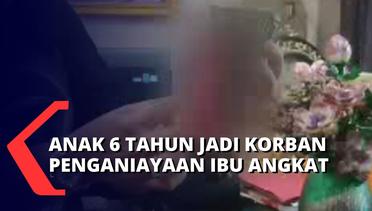 KPAID Cirebon Dapat Laporan Kekerasan Anak Oleh Ibu Angkat, Korban Alami Luka di Seluruh Tubuh!