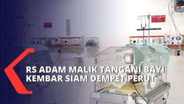 Sehari Setelah Dilahirkan, Bayi Kembar Siam di Asahan Dirujuk ke Rumah Sakit Adam Malik Medan