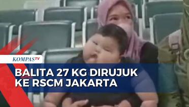 Alami Obesitas, Balita 27 Kg di Bekasi Dirujuk ke RSCM Jakarta
