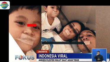 Indonesia Viral: Manfaat Plester Mulut saat Tidur - Fokus
