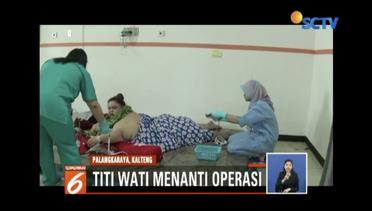 Titi Wati, Wanita Berbobot 220 Kg Akan Jalani Operasi Bariatrik – Liputan 6 Siang
