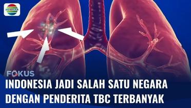 INFUS: Indonesia Jadi Peringkat Dua sebagai Negara dengan Penderita TBC Terbanyak di Dunia | Fokus