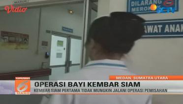 Operasi Pemisahan Bayi Kembar Siam di Medan - Liputan6 Siang