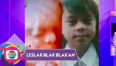 Mirip Lesti Banget!!! Billar Sandingkan Foto Lesti SD Dengan Foto USG | Leslar Blak Blakan