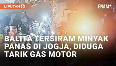 Viral Balita Tersiram Minyak Panas Saat Beli Gorengan di Jogja, Diduga Tarik Gas Motor yang Menyala