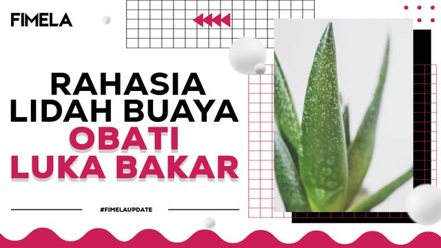 Tak Perlu Panik! Atasi Luka Bakar dengan Masker Lidah Buaya yang Terbukti Efektif!