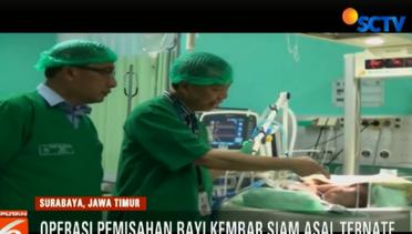 Tim Dokter RSUD Soetomo Surabaya Sukses Operasi Pisah Bayi Kembar Siam Ternate - Liputan6 Malam