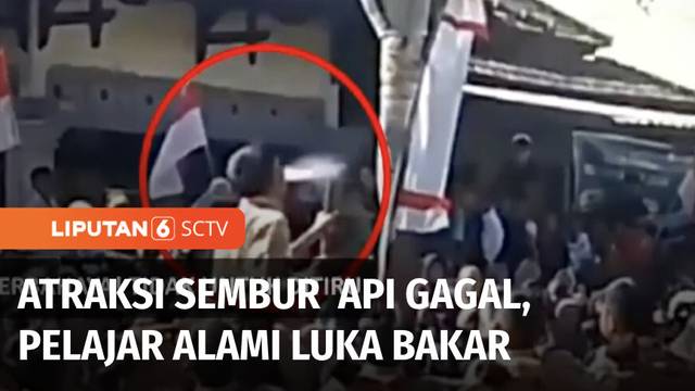 Lomba Gerak Jalan Peringatan 17 Agustus, Bocah Alami Luka Bakar Gagal Atraksi Sembur | Liputan 6