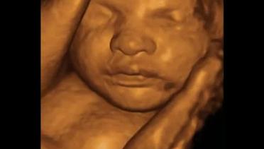 Video Hasil MRI Perlihatkan Bayi di Dalam Rahim Lebih Jelas