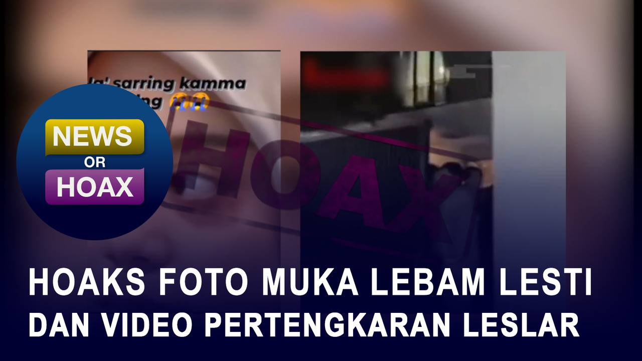 Hoax Foto Muka Lebam Lesti Kejora Dan Video Pertengkaran Leslar - NEWS
