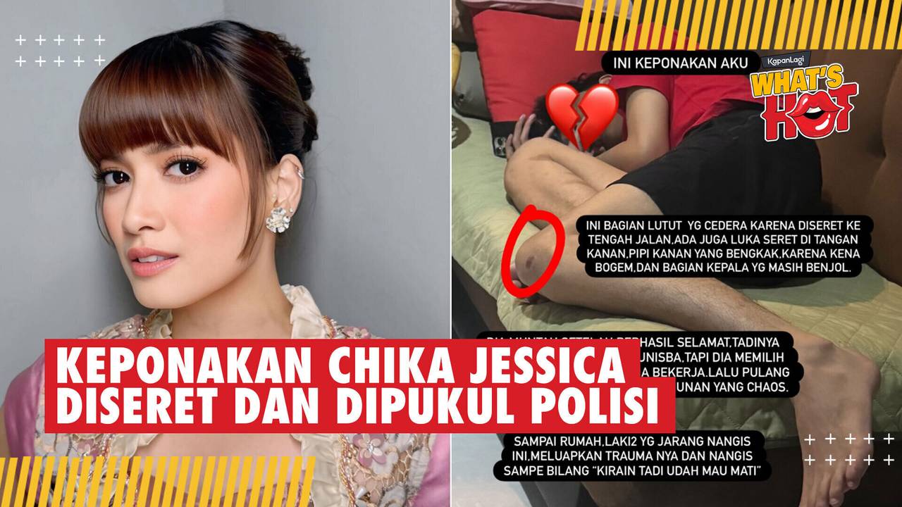 Keponakan Diseret dan Dipukul Polisi, Chika Jessica Speak Up di Media ...