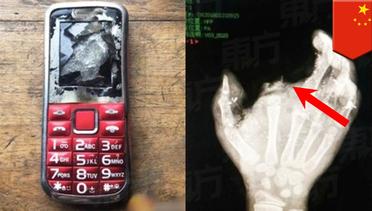 Made in China: Insiden ponsel meledak di tangan anak, jarinya sampai …  - TomoNews